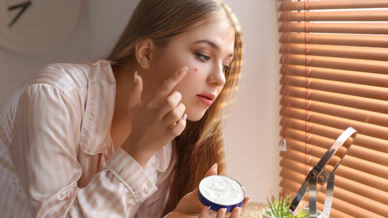 home remedy for psoriasis